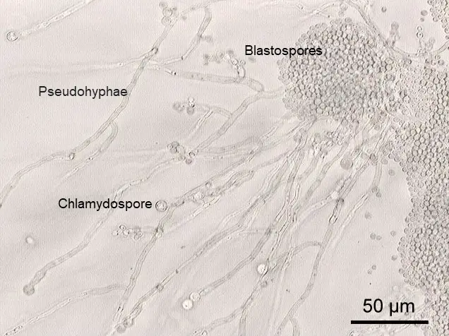 Micrografía de Candida albicans con pseudohifas y clamidosporas observadas al microscopio.