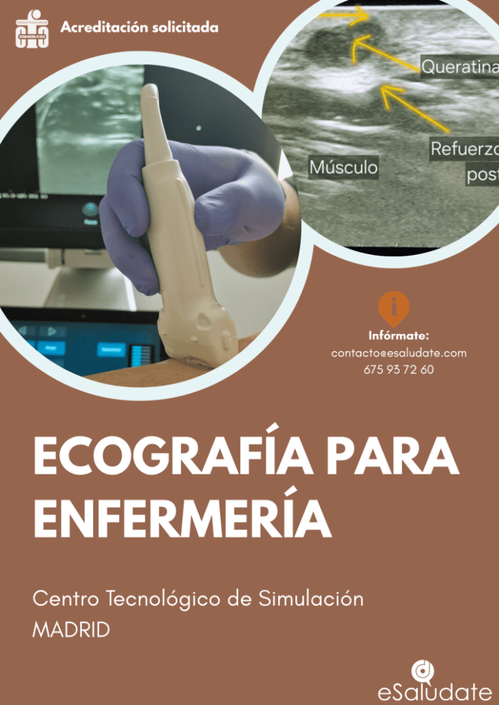 Curso de ecografía para enfermería en Madrid con uso de ecógrafo en práctica clínica