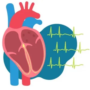 Importancia de la correcta interpretación del ECG en urgencias y emergencias