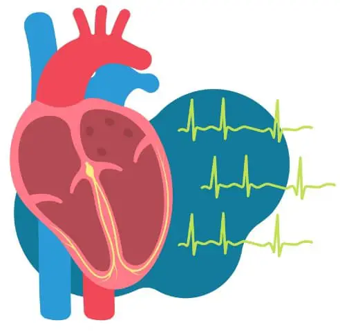 Importancia de la correcta interpretación del ECG en urgencias y emergencias