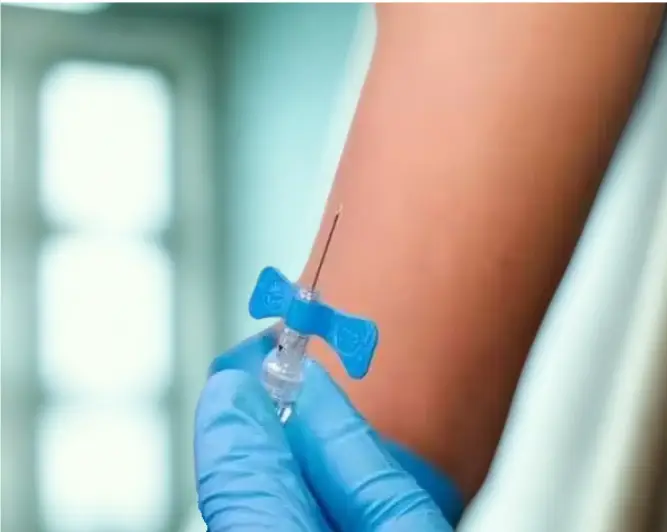 Canalización venosa periférica en un paciente con acceso vascular difícil, utilizada como apoyo visual en el apartado sobre obtención de hemocultivos cuando la venopunción resulta complicada.